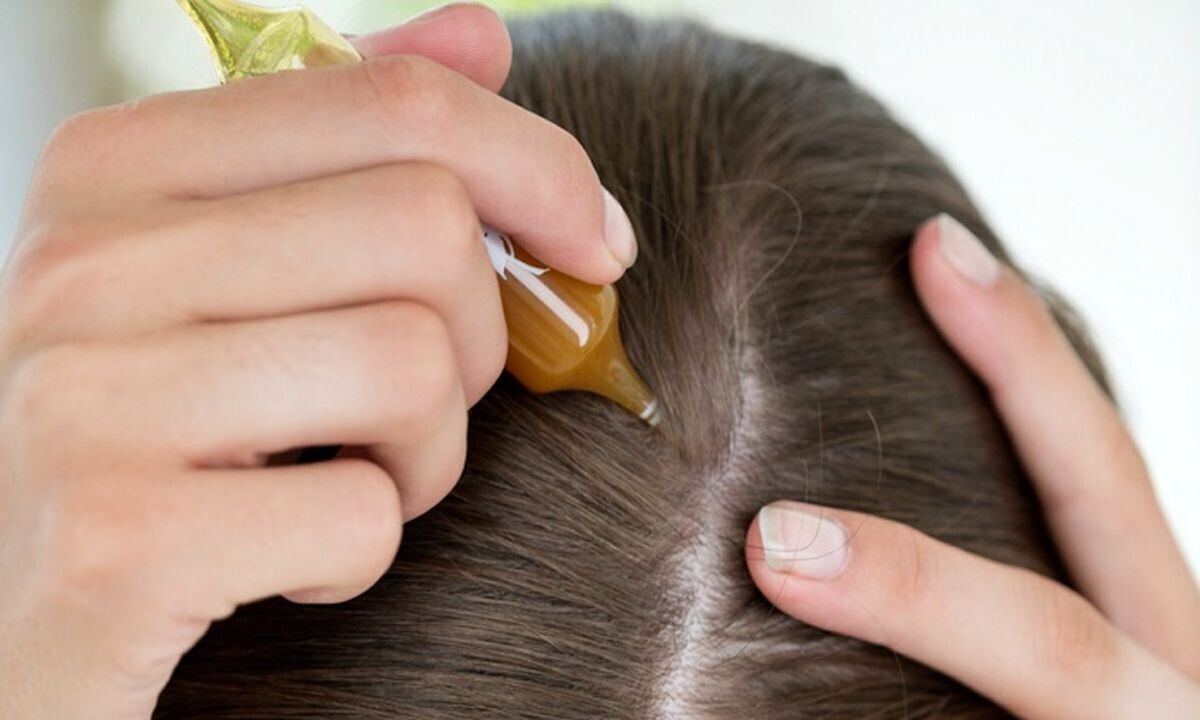 روغن های گیاهی و ریزش مو 
